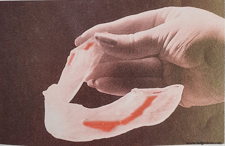30 años de Materialise: Avanzando la impresión 3D médica para resultados de pacientes más seguros y predecibles