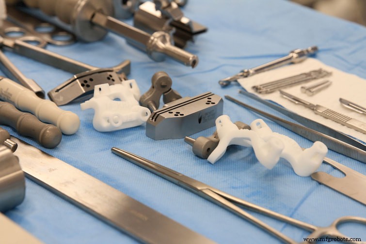30 años de Materialise: Avanzando la impresión 3D médica para resultados de pacientes más seguros y predecibles
