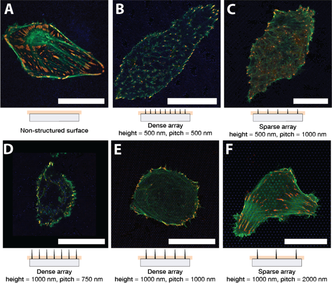 Modulación del Citoesqueleto de Actina y Adhesiones Focales Inducida por Nanopilares en Células U2OS