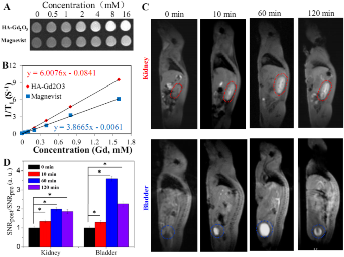 Nanopartículas de Gd₂O₃ funcionalizadas con ácido hialurónico: Mejora de la radioterapia guiada por RM para tumores