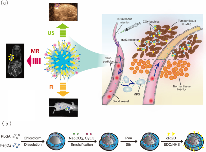 Nanopartículas biodegradables, sensibles a tumores, para imagen dual de cáncer de mama