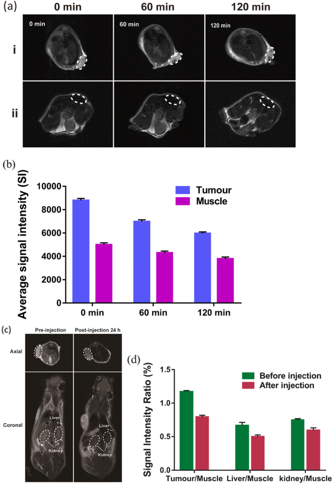 Nanopartículas biodegradables, sensibles a tumores, para imagen dual de cáncer de mama