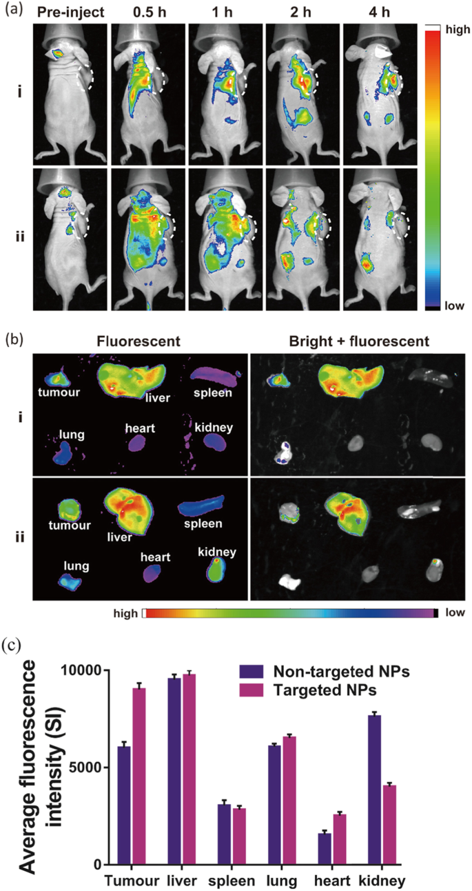 Nanopartículas biodegradables, sensibles a tumores, para imagen dual de cáncer de mama